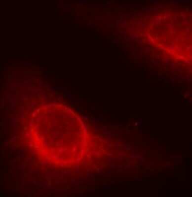 Immunocytochemistry/ Immunofluorescence: Cofilin [p Ser3] Antibody - Azide and BSA Free [NBP3-05394]